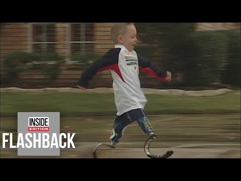 Boy Born With No Legs Giggles as He Runs on Blades