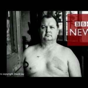 The accurate thing about scars: portraits of irascible beauty – BBC Info