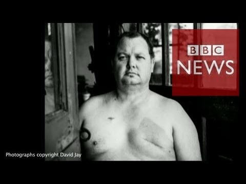 The accurate thing about scars: portraits of irascible beauty – BBC Info