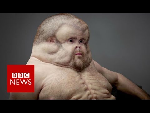 Graham, the ‘fracture-proof individual’ – BBC Files
