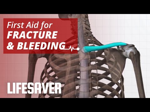 FIRST AID: Fracture and Bleeding | Lifesaver