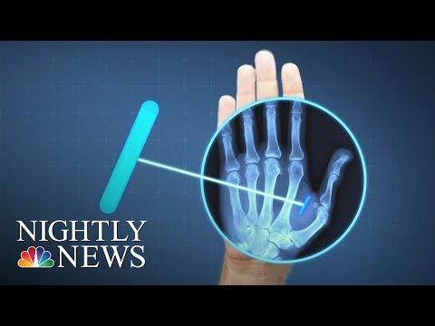 ID, Pockets, Keys All In Your Hand: Sweden Moves Into The Future With Microchipping | Nightly Data
