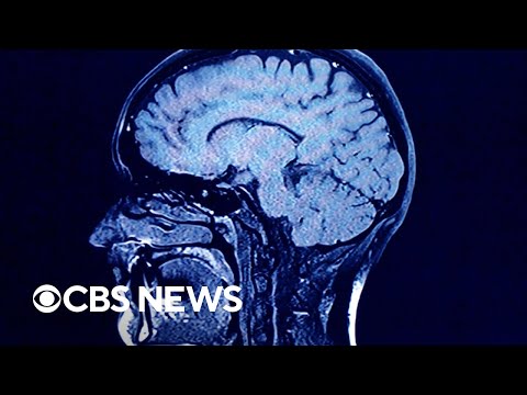 What happens to our brains after we die? A new look might per chance well present solutions