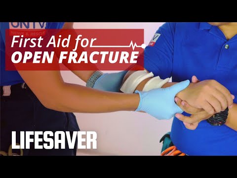 First Aid for Launch Break | LIFESAVER