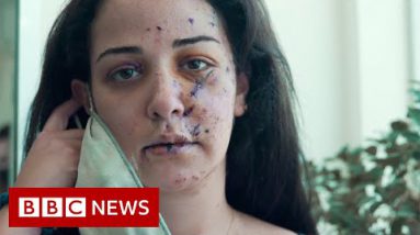Fixing the scars of Beirut’s explosion – BBC Info
