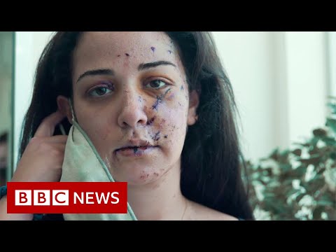 Fixing the scars of Beirut’s explosion – BBC Info