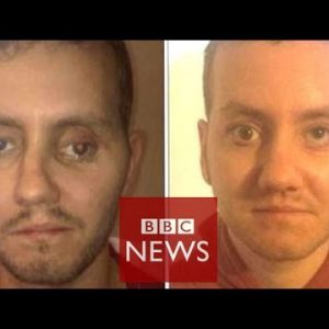 ‘3D printer helped rebuild my face’ – BBC Records