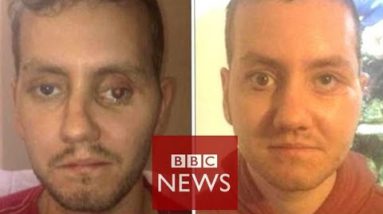 ‘3D printer helped rebuild my face’ – BBC Records